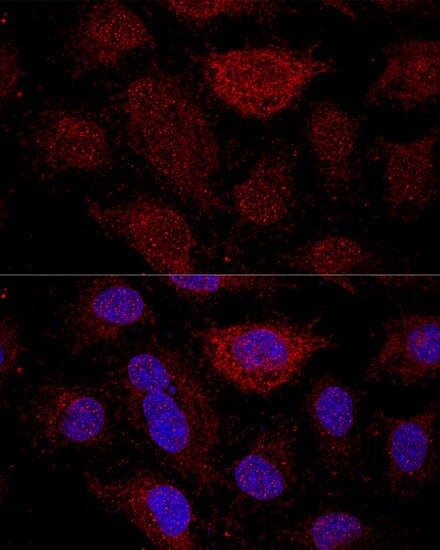 RPL21 Antibody - Azide and BSA Free