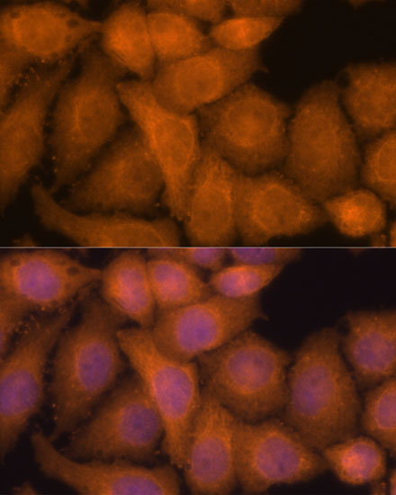 ZC3H7A Antibody - Azide and BSA Free