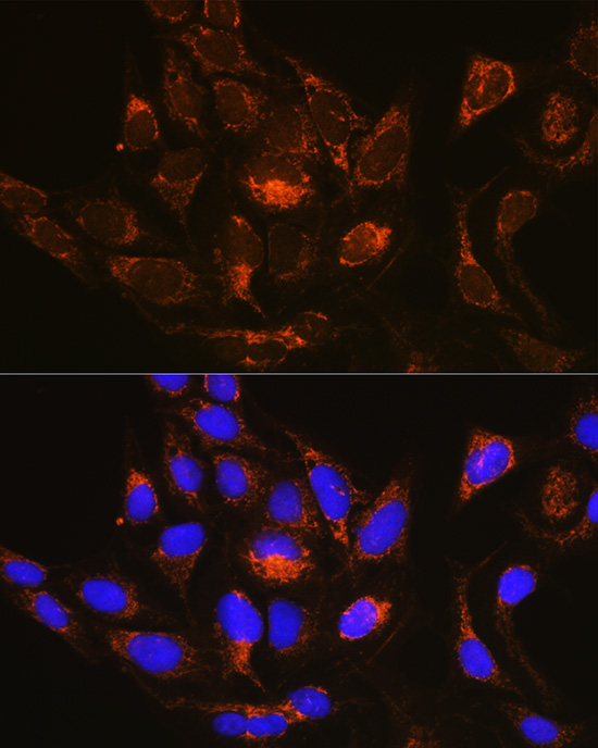 Rab13 Antibody - Azide and BSA Free