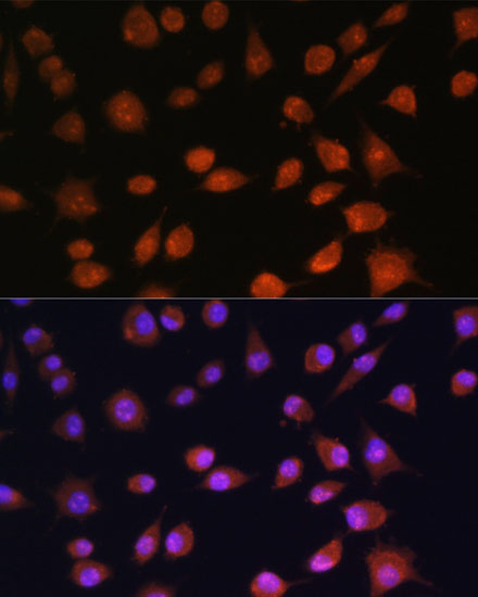 RPS19BP1 Antibody - Azide and BSA Free