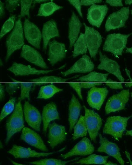 SARDH Antibody - Azide and BSA Free