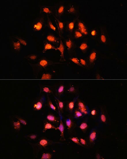 PHLPP Antibody - Azide and BSA Free