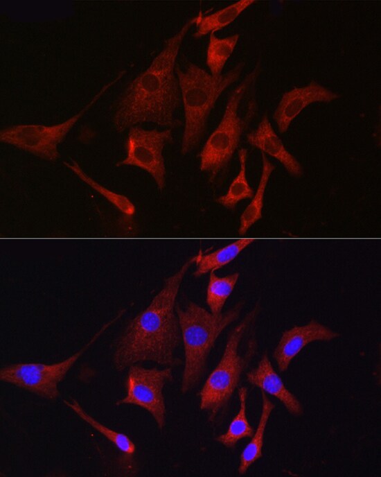 TMPRSS2 Antibody - Azide and BSA Free