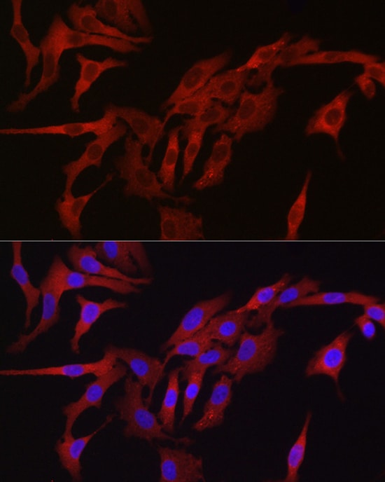 TMPRSS2 Antibody - Azide and BSA Free