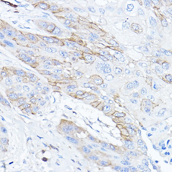 TMPRSS2 Antibody - Azide and BSA Free