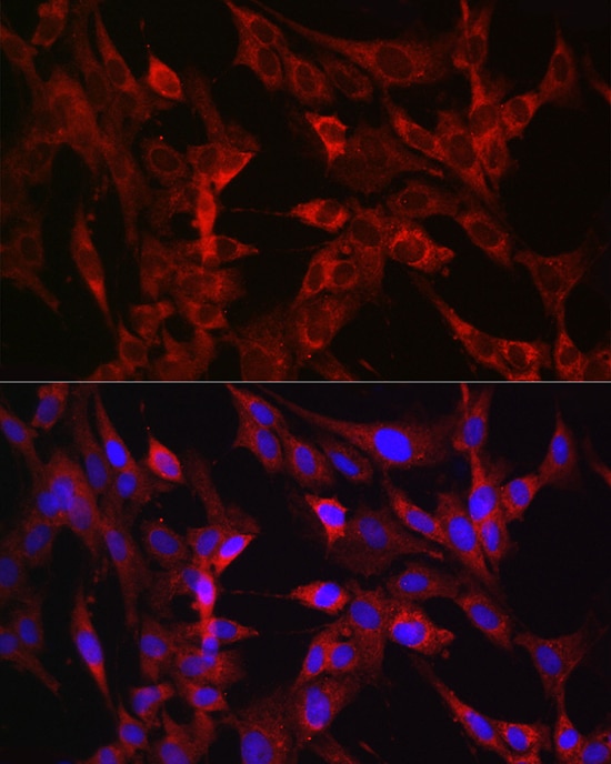 TMPRSS2 Antibody - Azide and BSA Free