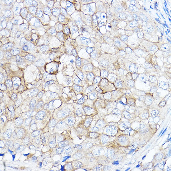 TMPRSS2 Antibody - Azide and BSA Free