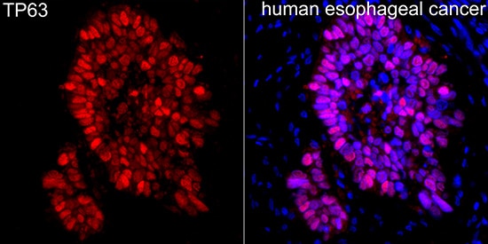 p63/TP73L Antibody - Azide and BSA Free