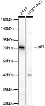 p63/TP73L Antibody - Azide and BSA Free