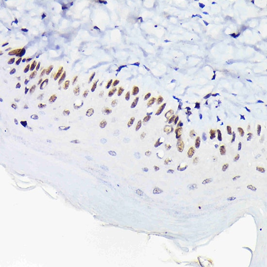 p63/TP73L Antibody - Azide and BSA Free