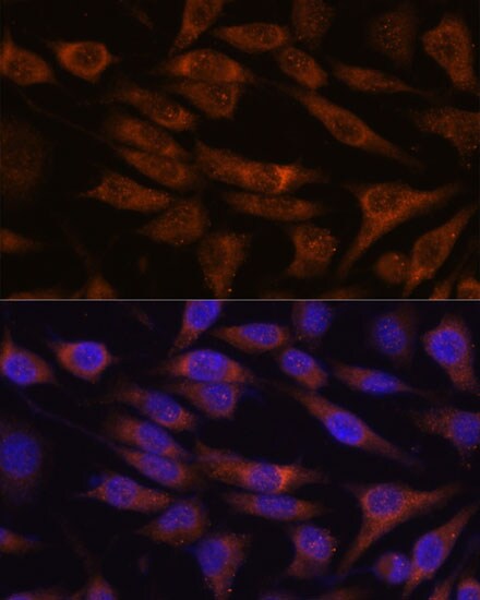 UNC13B Antibody - Azide and BSA Free
