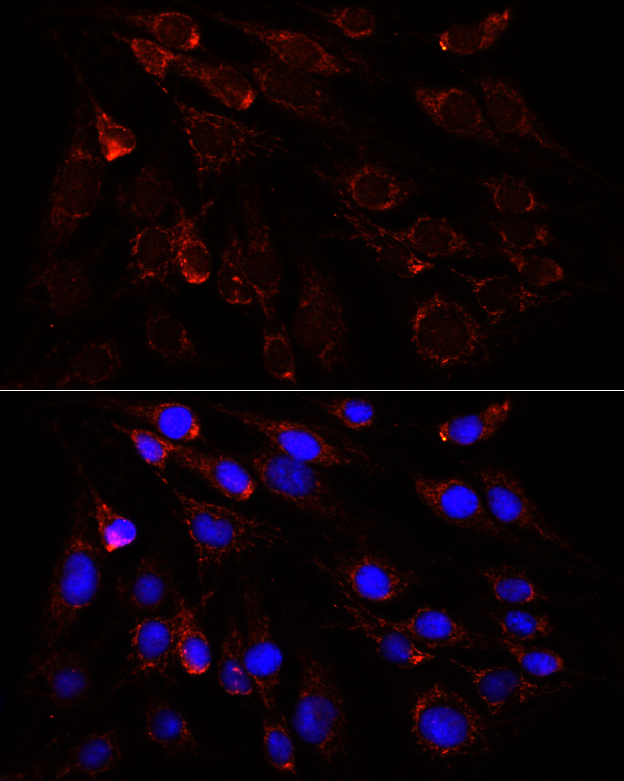 SLC25A1 Antibody - BSA Free