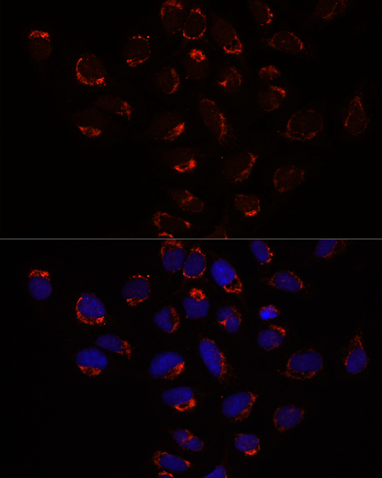SLC25A1 Antibody - BSA Free