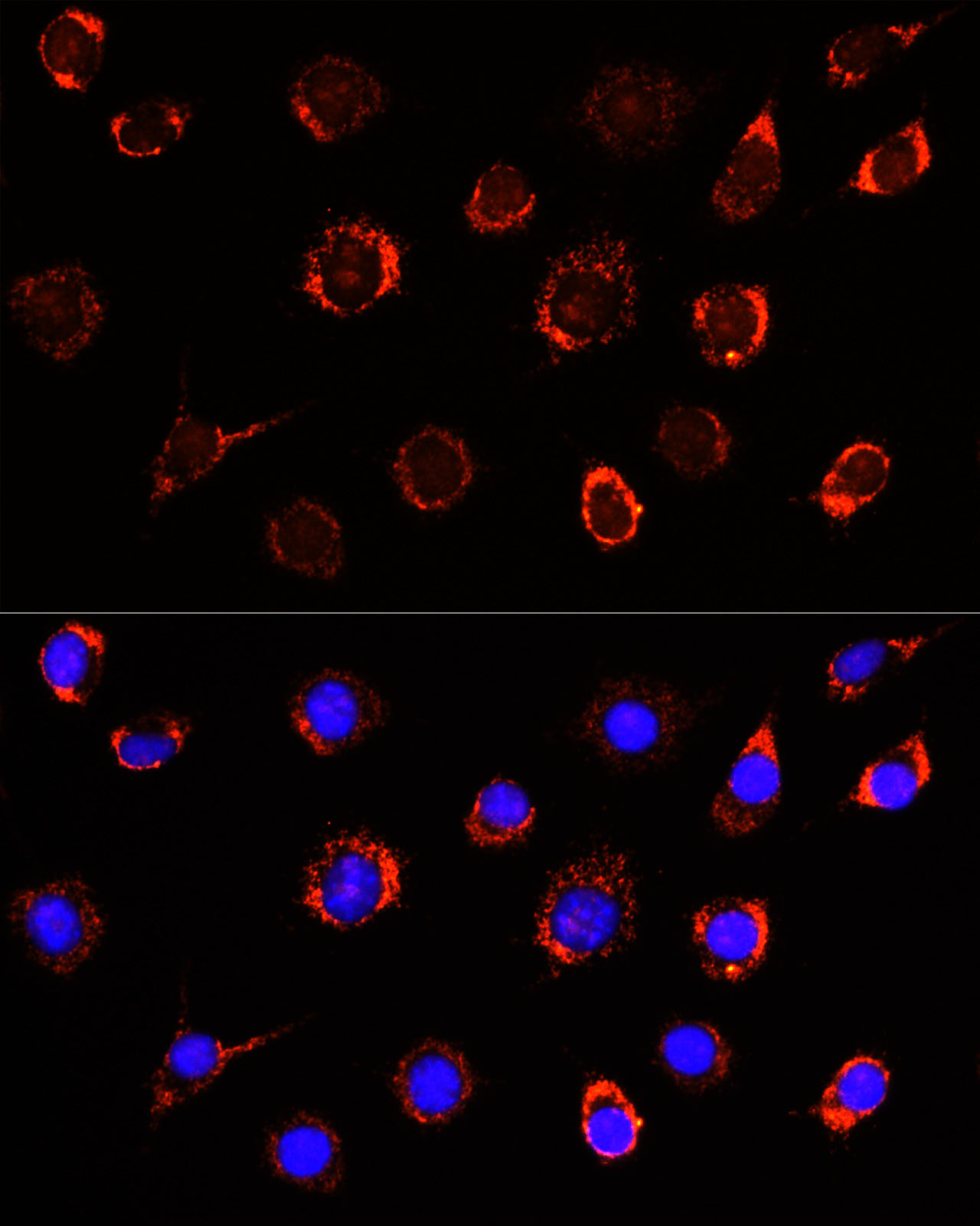 SLC25A1 Antibody - BSA Free