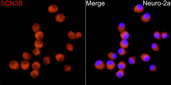 SCN3B Antibody - BSA Free