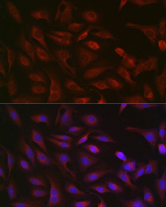 GSDMDC1 Antibody - Azide and BSA Free