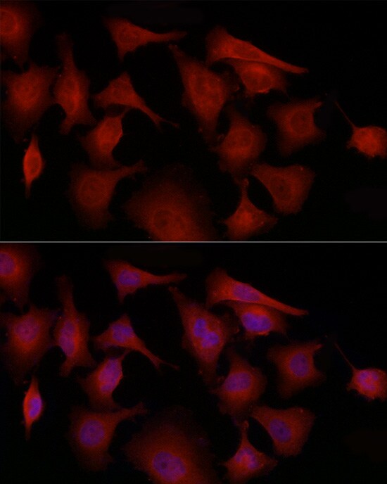 GSDMDC1 Antibody - Azide and BSA Free