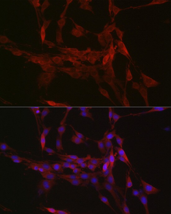 GSDMDC1 Antibody - Azide and BSA Free