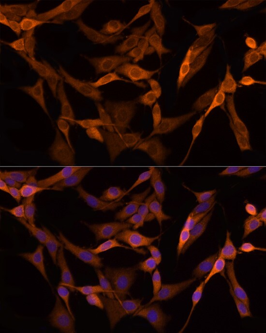 GSDMDC1 Antibody - Azide and BSA Free