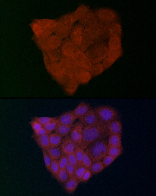 GSDMDC1 Antibody - Azide and BSA Free