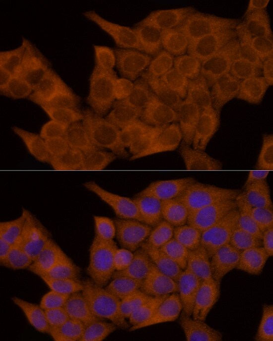 GSDMDC1 Antibody - Azide and BSA Free