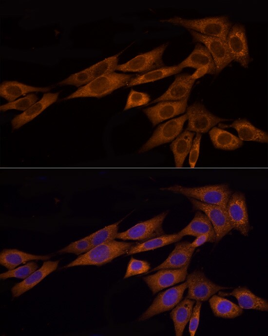 GSDMDC1 Antibody - Azide and BSA Free