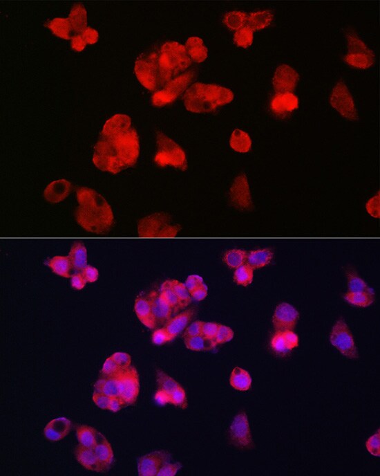 TfR2 Antibody - Azide and BSA Free