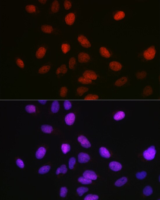 SETD8 Antibody - BSA Free