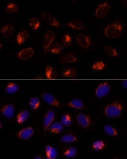 TXNDC12 Antibody - Azide and BSA Free