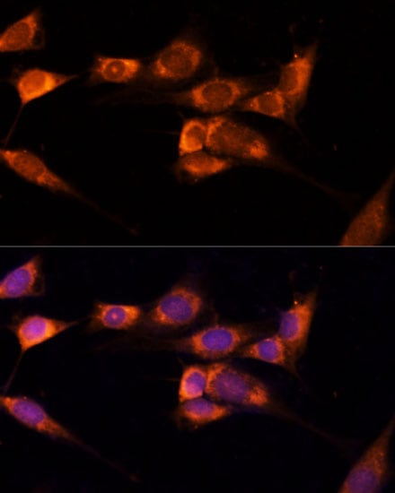 TXNDC12 Antibody - Azide and BSA Free