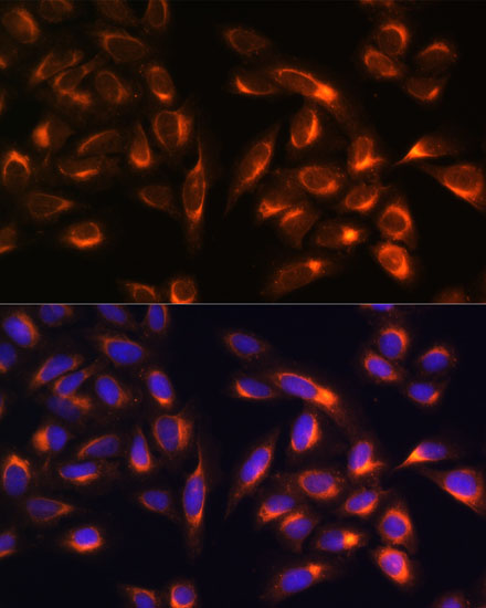 PTCD1 Antibody - Azide and BSA Free