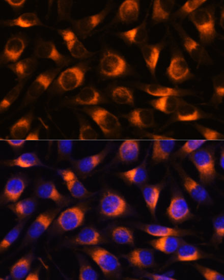 VAT1 Antibody - Azide and BSA Free