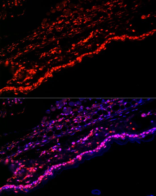 SPRR1A Antibody