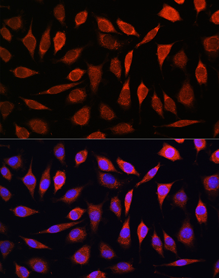 SLC39A8/ZIP8 Antibody - BSA Free