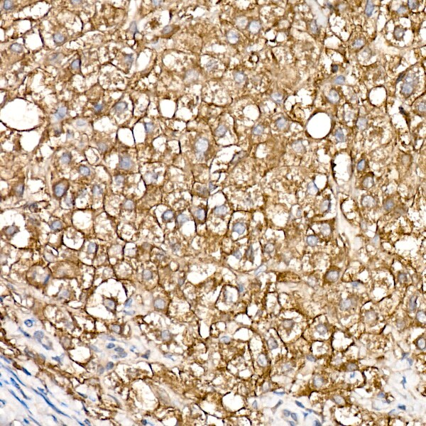 SLC39A14 Antibody - Azide and BSA Free