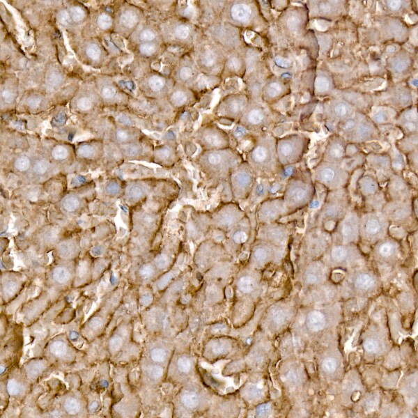 SLC39A14 Antibody - Azide and BSA Free