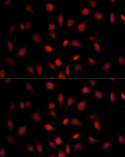Proteasome beta 1 Antibody - BSA Free