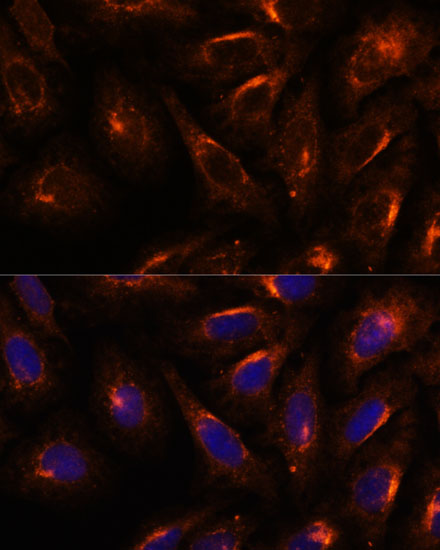 SCAMP2 Antibody - Azide and BSA Free