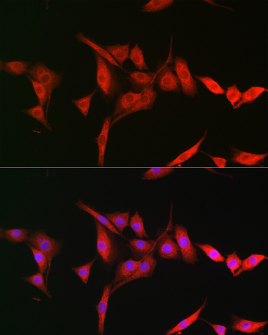 TRIM31 Antibody - BSA Free