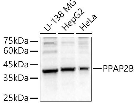 PPAP2B Antibody
