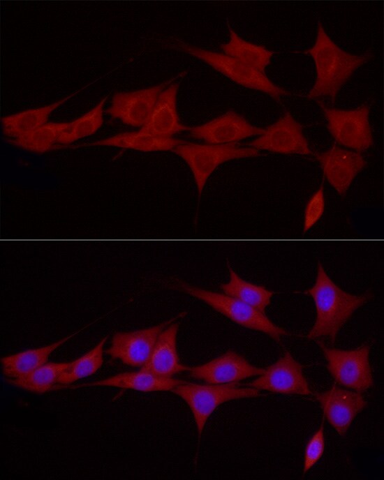SGPL1 Antibody - Azide and BSA Free