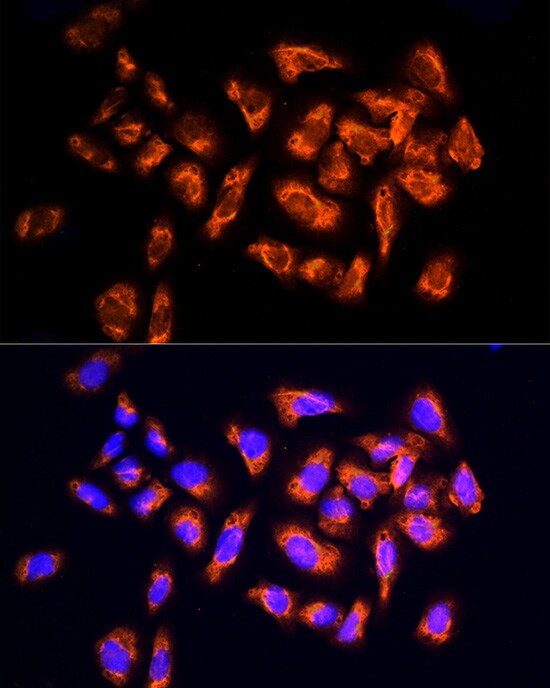 NPHP4 Antibody - Azide and BSA Free