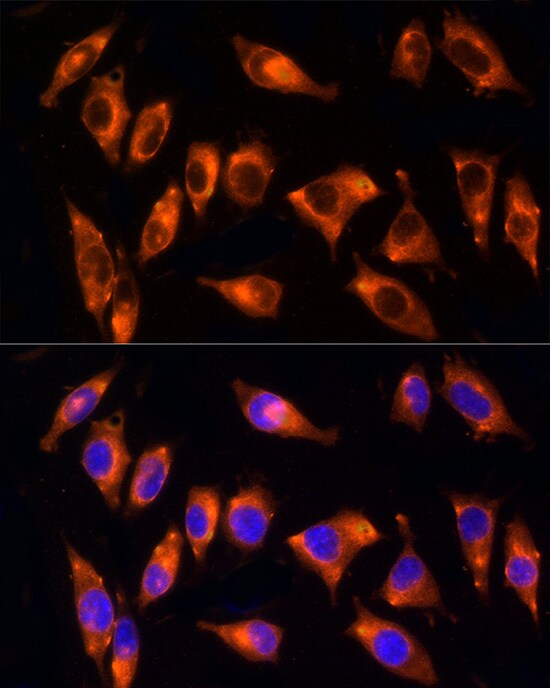 NPHP4 Antibody - Azide and BSA Free