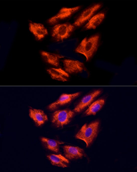NPHP4 Antibody - Azide and BSA Free