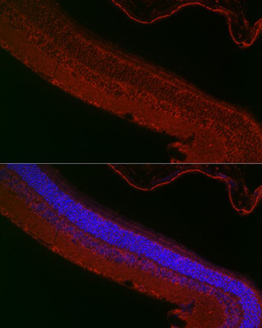 RPGR Antibody