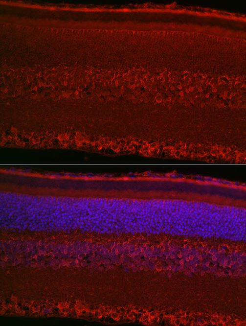 RPGR Antibody