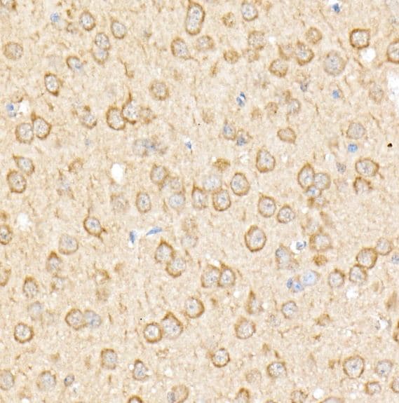 RPGR Antibody