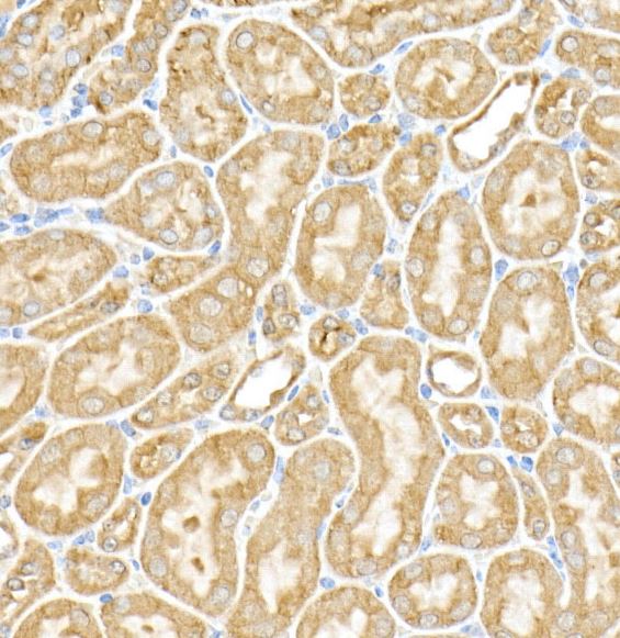 RPGR Antibody