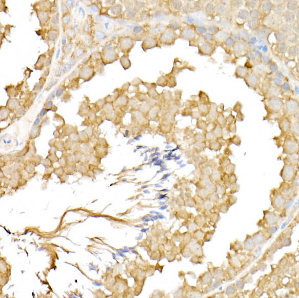 RPGR Antibody