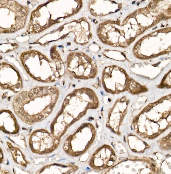 UCH-L5/UCH37 Antibody